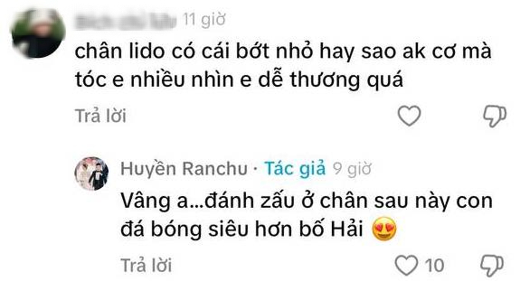 Con trai hơn 1 tháng tuổi bị "soi" vết bớt ở chân, Chu Thanh Huyền đáp lời khéo léo tiện thể "flex" về Quang Hải- Ảnh 2.